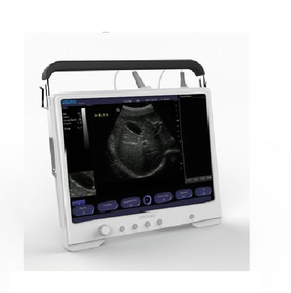 Apollo 9 Plus - Touch Screen Battery Operated Ultrasound Machine.jpg