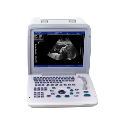 Apollo 7 - Best Economical Portable Ultrasound Scanners