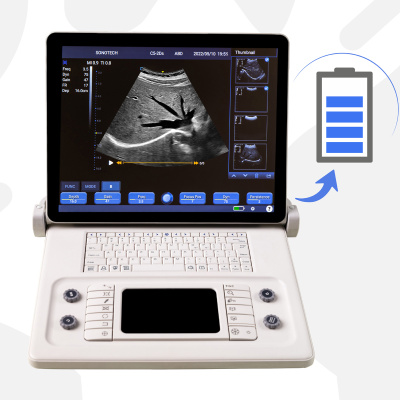D8 Youkey - 15" inch Highly Professional Notebook Ultrasound